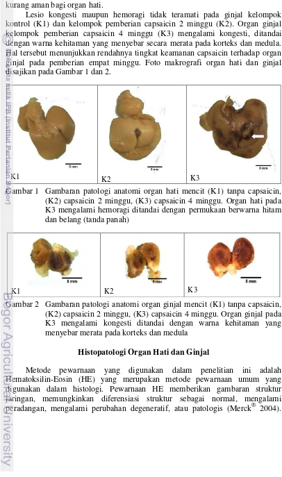 Gambar 1  Gambaran patologi anatomi organ hati mencit (K1) tanpa capsaicin, 