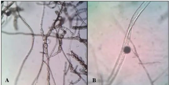 Gambar 5  Morfologi hifa dan klamidospora pada manggis. Hifa membengkak  seperti sate (A); pembentukan klamidospora secara interkaler (B),  dengan perbesaran 40x