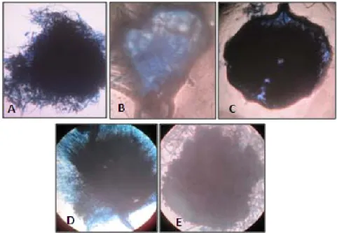 Gambar 6  Piknidia B. theobromae yang terbentuk pada media WA + jerami padi  (A, B, C, D) dan WA + kulit manggis (E)