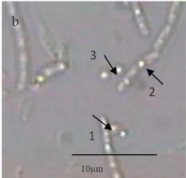 Gambar 1.Sel B. thuringiensis subsp. aizawai. (a) Pengamatan dengan pewarnaan kristal,  (b) pengamatan dengan mikroskop fase kontras dengan perbesaran 1000 x