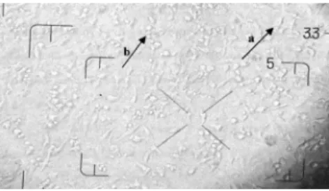 Gambar 3.  a) Sel HeLa yang mati; b) Sel HeLa yang masih hidup Figure 3. a) Death HeLa cell; b) Life HeLa cell
