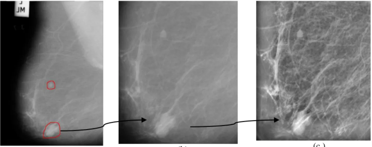 Gambar 3. (a) ROI Mass, (b) Crop Mammogram, (c ) CLAHE dengan Clip Limit 0.02 