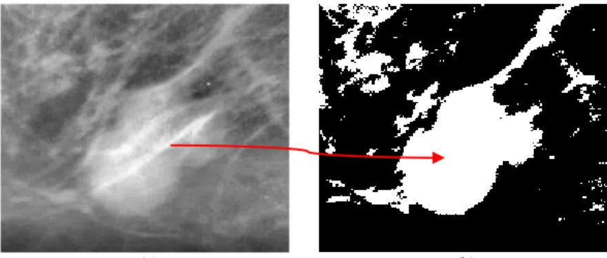 Gambar 4. (a) Gambar gumpalan massa (b) Segmentasi Otsu  2.5  Ekstraksi Ciri 