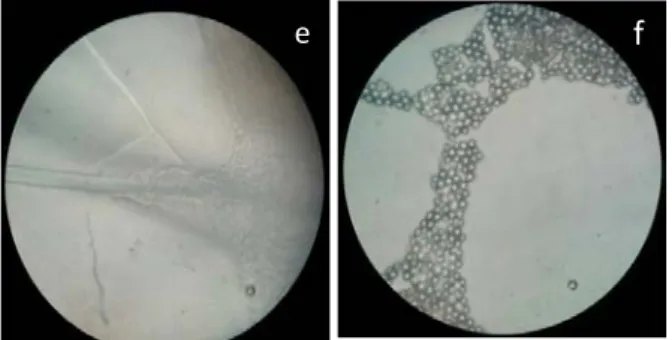 Gambar 6. Foto mikroskopis cendawan dalam ragi Rhizopus oryzae (Perbesaran   a.10x, b.40x, c.100x), Saccharomyces cerivisae (d.10x, e.40x, f.100x) Aspergillus 