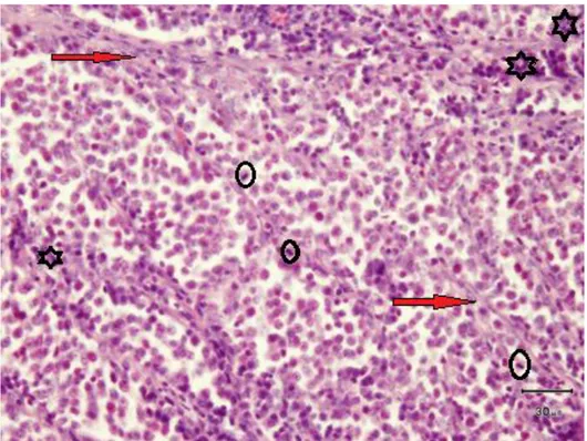 Gambar 4. Mikroskopis Venereal Sarcoma pada Anjing Lokal Jantan dan Betina: Sel-sel Tumor  terlihat  homogen,  bentuknya  polihedral,  menyerupai  sel-sel  limfoblas  dan  relatif  hiperkromatis