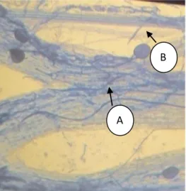 Gambar 1. Kolonisasi Fungi Mikoriza  Arbuskular  (FMA)  pada  akar    tanaman  P. 