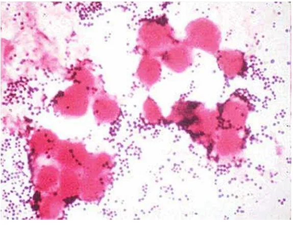 Gambar 4.Staphylococcus aureus (http://textbookofbacteriology.net/staph.html)