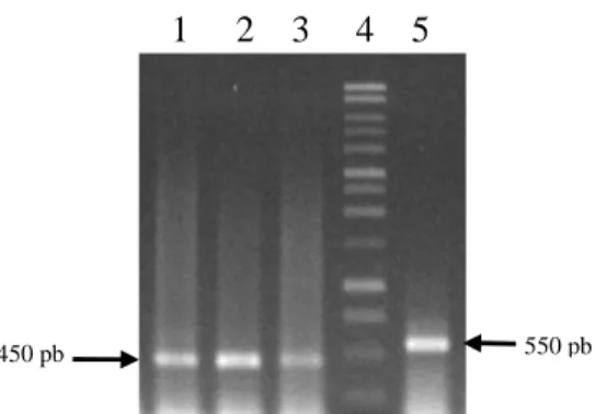 Gambar 6. Hasil amplifikasi β-actin. Lajur 1,2, dan 3 = hasil amplifikasi dengan  menggunakan cDNA sebagai cetakan