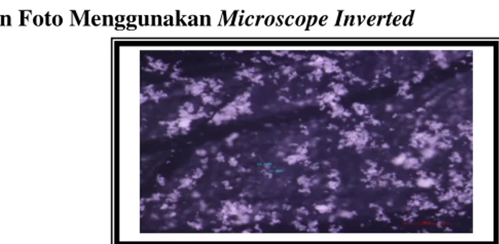 Gambar 9. Pengamatan Serbuk Cangkang Kerang Menggunakan Microscope Inverted 