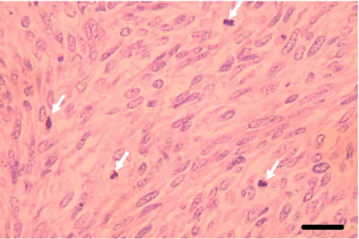 Gambar 7  Gambaran histopatologis sel tumor leiomiosarkoma pada paru-paru  disertai figur mitotik (ß)