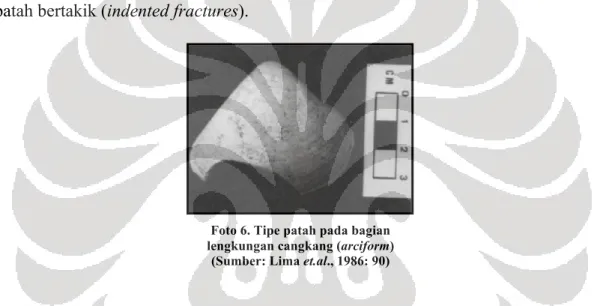 Foto 7. Tipe patah melintang (transverse) pada bagian (a) inferior, dan (b) superior   (Sumber: Lima et.al., 1986: 90, 93) 