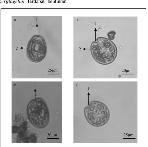 Gambar 2. Kelompok Prorocentroid: (a) Prorocentrum lima;  