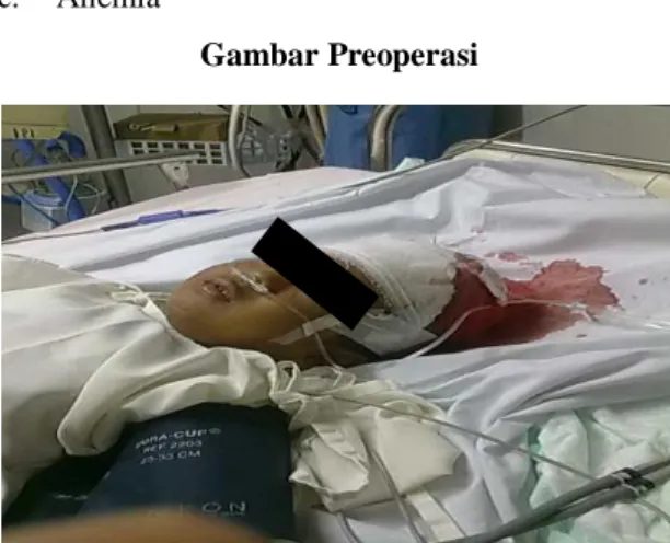 Gambar Preoperasi 