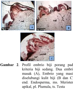 Gambar  1.  Profil  embrio  biji  porang  pada  kriteria  biji  kecil.  Embrio  masak  (A),  Embrio  yang  masih  diselubungi  kulit  biji  (B),  Embrio  yang  tidak  mengandung  embrio  (C);  bp