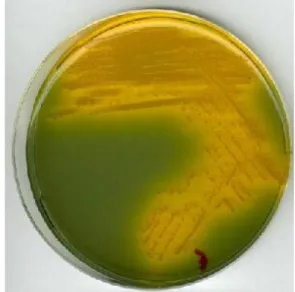 Gambar 1.   Pertumbuhan V. Cholerae  pada Medium Agar TCBS   Hasil  uji  aglutinasi  dengan  antiserum  polivalen  V