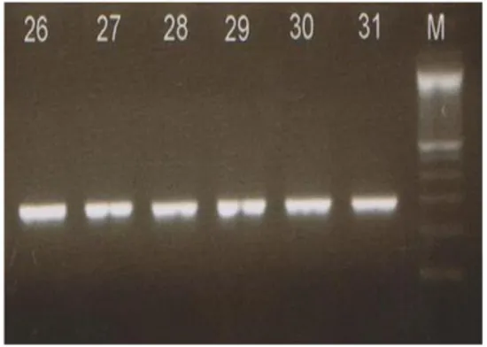 Gambar 2.  Hasil  elektroforesis  amplify- amplify-kasi  gen  ctx  dengan  Gel  Agarosa  2%  (M:  marker,  31: 