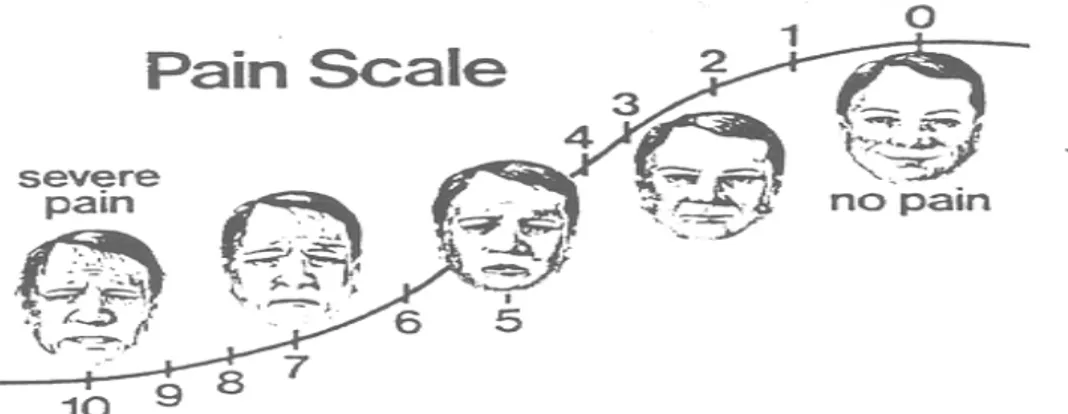 Gambar 2.7-4. Visual Analogue Scale 