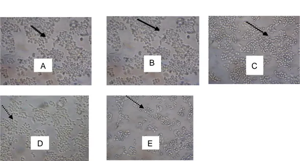 Gambar 2. Morfologi sel HeLa pada perlakuan ekstrak etanol daun kemangi.  Kelompok kontrol  sel  (A),  konsentrasi  5  µg/mL  (B),  konsentrasi  50  µg/mL  (C),  konsentrasi  100  µg/mL  (D),  dan  konsentrasi  500  µg/mL  (E)