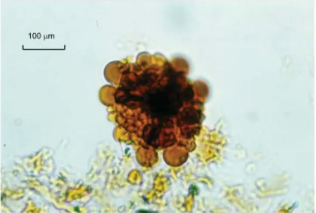 Gambar 9. Mikrofoto dari polen Meyeripollis naharkoten- naharkoten-sis batuan formasi Lakat yang menunjukkan umur Oligosen  Tengah sampai akhir
