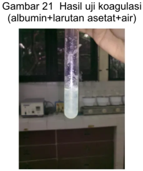 Gambar 21  Hasil uji koagulasi (albumin+larutan asetat+air)