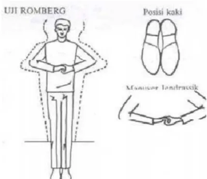 Gambar 1. Uji Romberg 