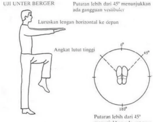 Gambar 2. Unterberger Tes