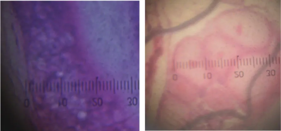 Gambar 2. Histologi Gonad dengan asetokarmin (a) jantan, (b) betina, (c) intersex. Perbesaran 40 X 