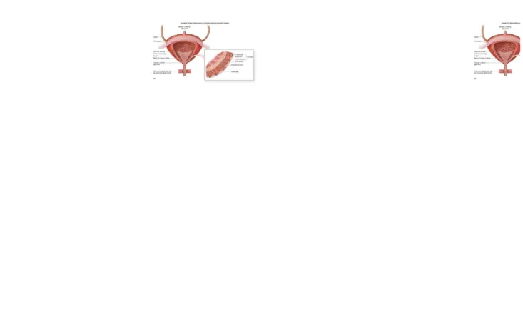 Gambar 1:  anatomi saluran kemih