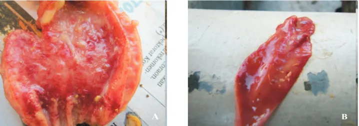 Gambar 1. Nekrosis hemoragik pada proventrikulus (A) dan usus halus  (B)