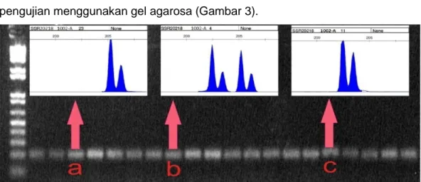 Gambar  3.  Perbedaan  elektroforesis  gel  dan  Genetic  Analyzer.  Pita  a  menunjukkan  pola  normal,  sedangkan  pita  b  dan  c  adalah  pola  menyimpang