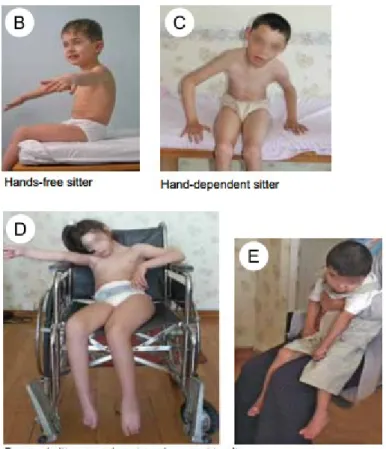 Gambar 9. Tingkat kemampuan duduk pada anak dengan CP 2. Keseimbangan : tanda Romberg, Unilateral standing balance test, hop test