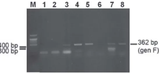 Gambar 2. Hasil amplifikasi gen F virus ND asal BB Vet Maros. Hasil positif ditunjukkan dengan band DNA sebesar 362 bp
