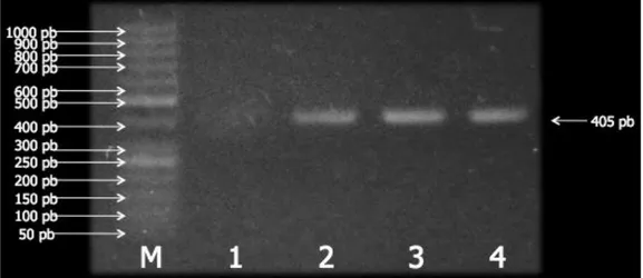 Gambar  1.  Hasil  elektroforesis  gen  penyandi  VP19  WSSV  dengan  marker  GenRuler TM   50  bp  DNA  Ladder