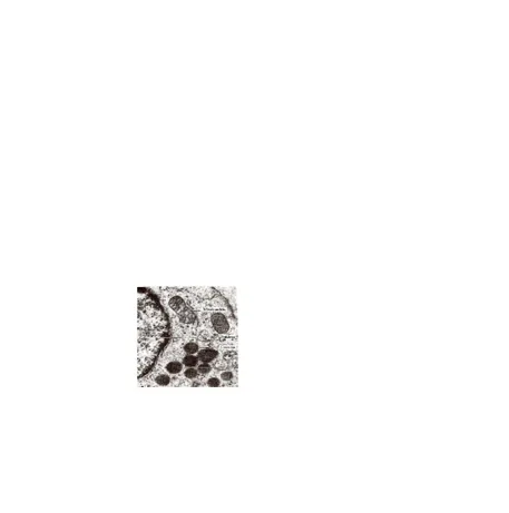Gambar  1.  Foto  mikrograf  electron  kelompok  lisosom  dekat  mitokondria  (Sheeler  danGambar  1