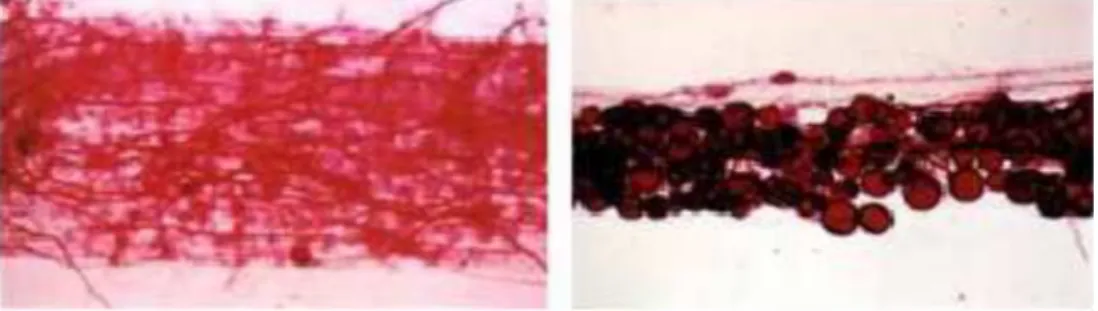 Gambar 1. Kolonisasi cendawan MA dalam akar padi penuh dengan hifa (kiri) dan penuhsop  dengan spora (kanan)