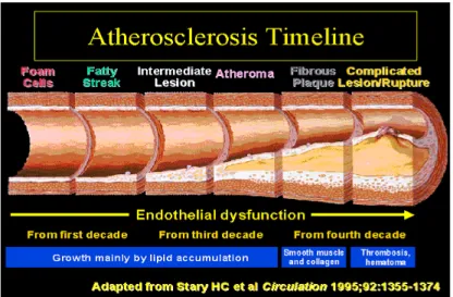 Gambar 2.  Garis waktu proses aterosklerosis 39  2.2.6. Proses Patologi Terkait Aterosklerosis 