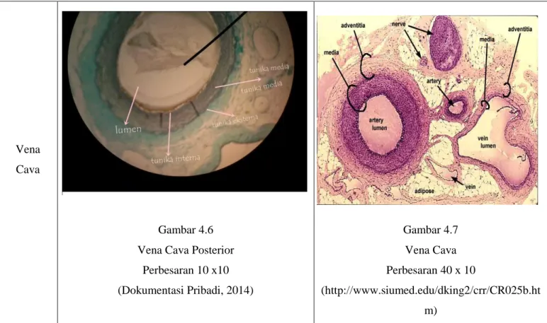 Gambar 4.6  Vena Cava Posterior 