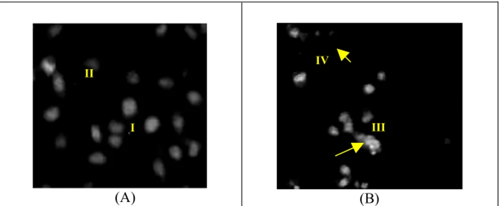 Gambar 4. Pengamatan induksi apoptosis dengan pengecatan akridin oranye/etidium bromida pada sel  kontrol (A) dan perlakuan  larutan uji 150 µg/ml (B)