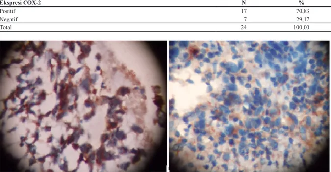 Tabel 2. Distribusi frekuensi ekspresi COX-2