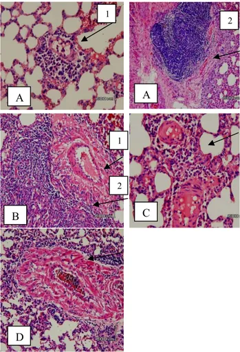Gambar 1.   Gambaran  Histopatologi Sel Paru Tikus. (A)  Kelompok kontrol DMBA, (B) Kelompok  Dosis Ekstrak 250 mg/kgBB, (C) Dosis  Ekstrak 500 mg/kgBB, (D) Dosis Ekstrak 750  mg/kgBB