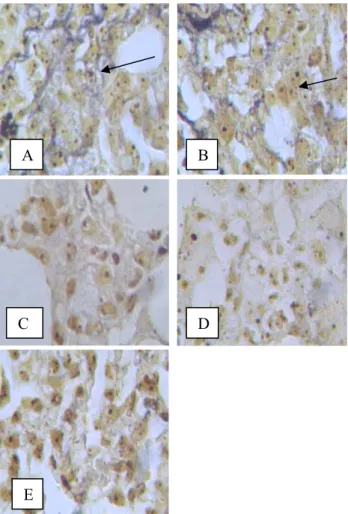 Gambar 2.   Gambaran  Histopatologi Hasil Pewarnaan  AgNOR dari Sel Paru Tikus (A) Kelompok  Kontrol DMBA (B) Kelompok Dosis Ekstrak  250 mg/kgBB (C) Kelompok  Dosis Ekstrak  500 mg/kgBB (D) Kelompok Dosis Ekstrak  750 mg/kgBB (E) Kelompok Kontrol Pelarut 