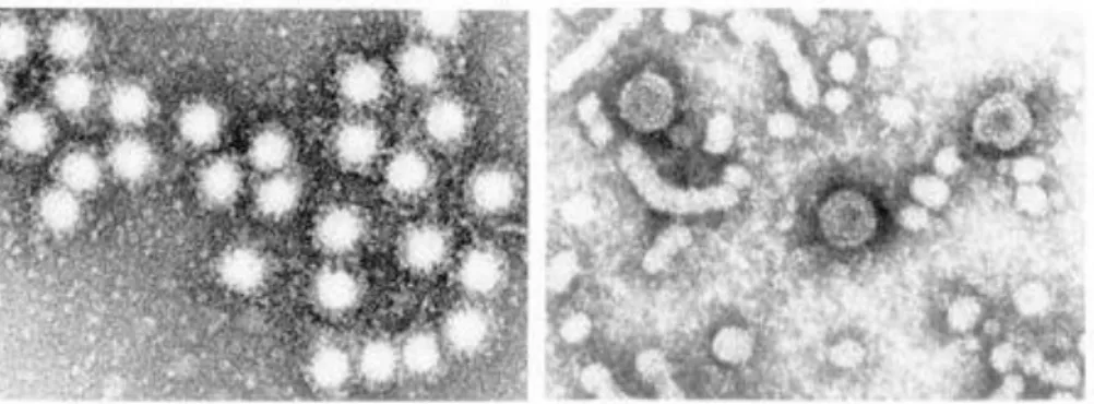 Gambar 1. Virus Hepatitis A 
