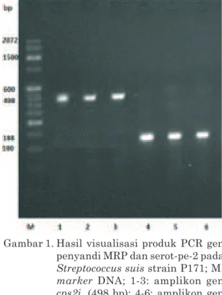Gambar 2. Hasil elektroforesis whole protein S.