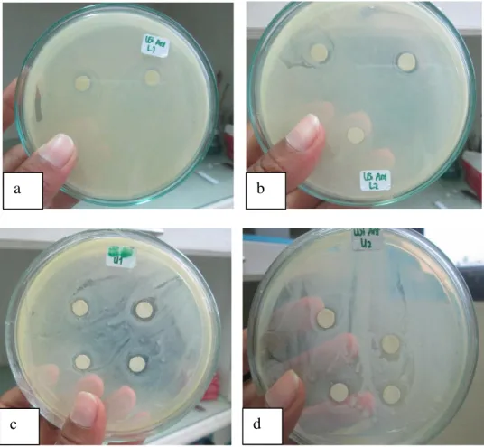 Gambar  4.  Indikasi  Penghambatan  bakteri  A.hydrophila  (a)  M.  varians  (b) M. varians (c) S