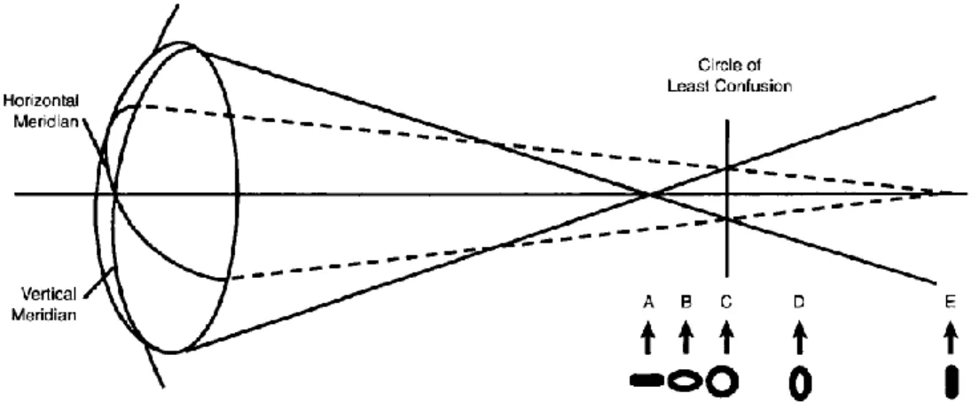 Gambar  3.  Distribusi  cahaya  dalam  interval  Sturm  terhadap  gambar  dari  sumber  titik  yang  dibentuk  oleh  with-the-rule  okular  silindris:  garis  horizontal  pada  fokus  meridian  vertikal yang lebih miopik (A); circle of least confusion (C),