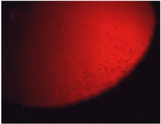 Gambar 2 : terlihat gambaran kornea menunjukkan retroiluminasi dengan titik titik kecil 