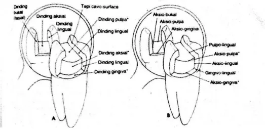 Gambar 4. Diagram preparasi gigi, nomenklatur dasar dari kavitas .  A.Dinding dan dasar B