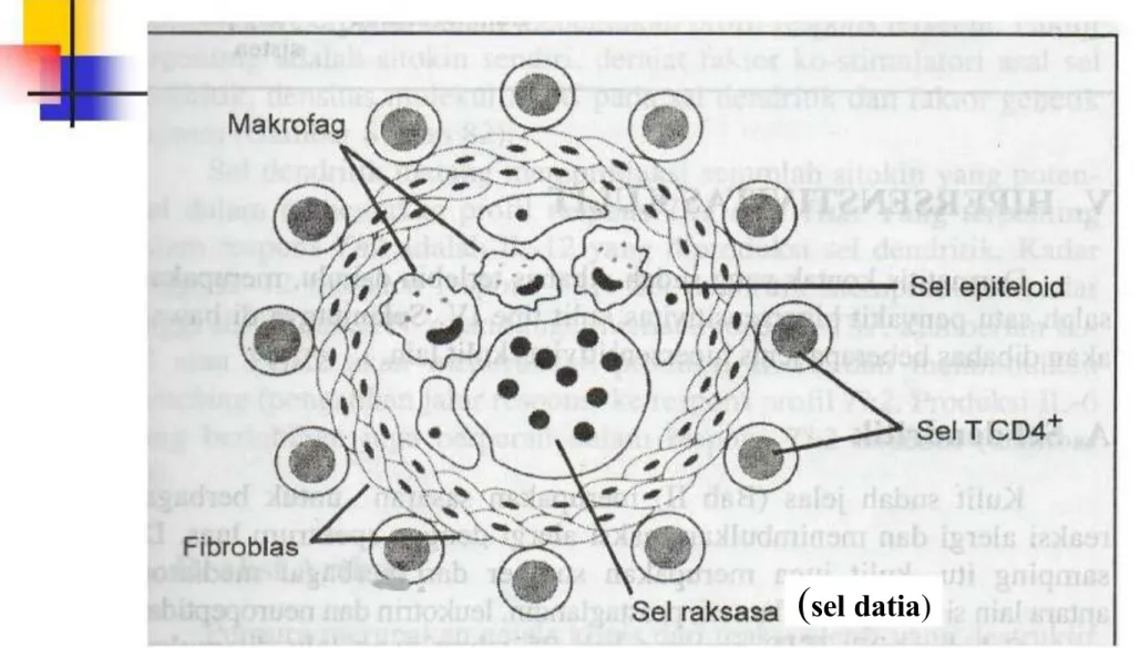 Gambar Reaksi Granuloma