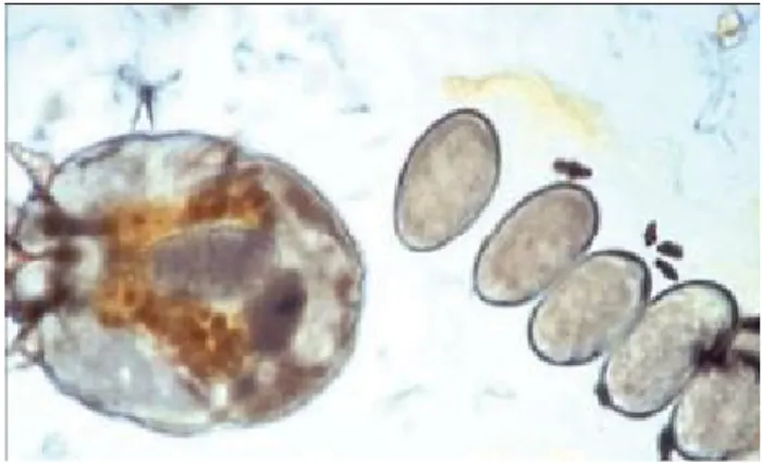 Gambar 11. Sarcoptes scabiei betina, telur, dan faeces.