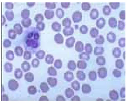 Gambar 2. Sel-sel eritrosit yang mengalami  miksrositik hipokrom